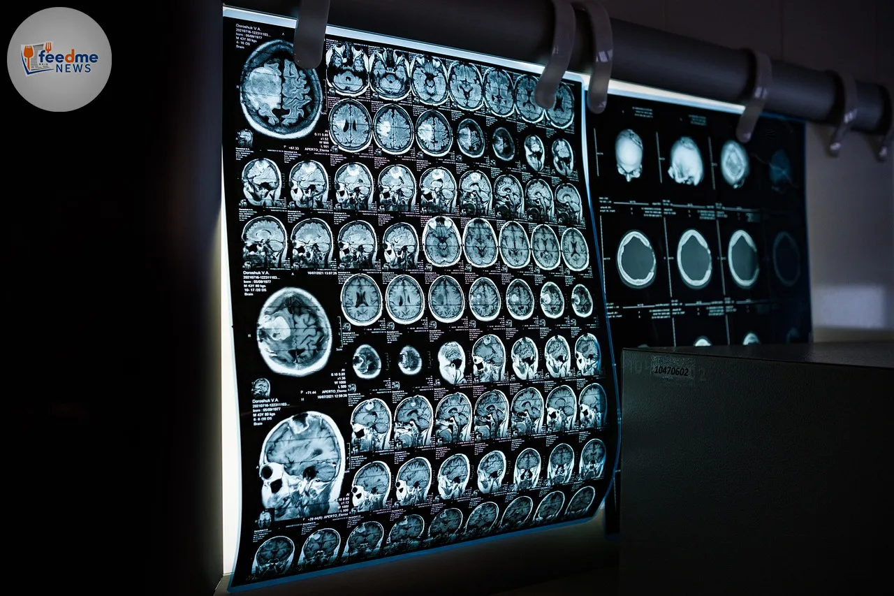 x-ray, mri, ct scan, computed tomography, magnetic resonance imaging, medicine, neurology, healthcare